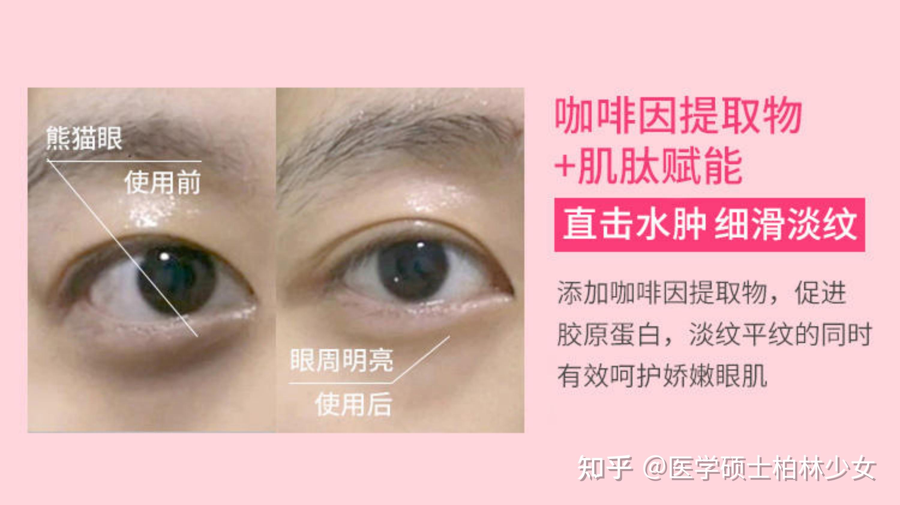 87保湿提亮,修护淡纹——遇见香芬肌肽早晚眼霜