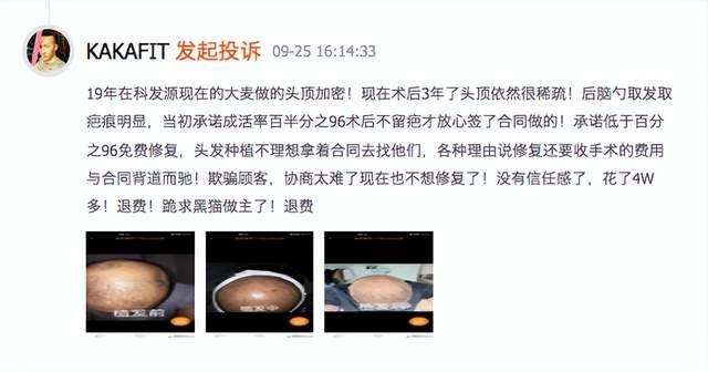 大麦植发效果差被投诉:李兴东年赚6611万 子公司多次被罚(图3)