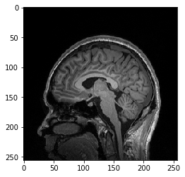 基于Python的MRI图像处理——数据转换与读取 - 知乎