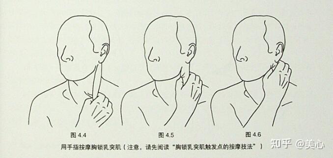 触发点疗法胸锁乳突肌