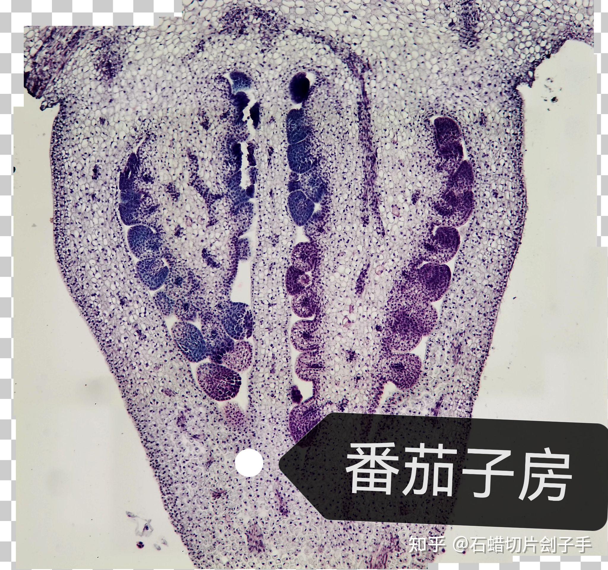 盘点我经手的石蜡切片
