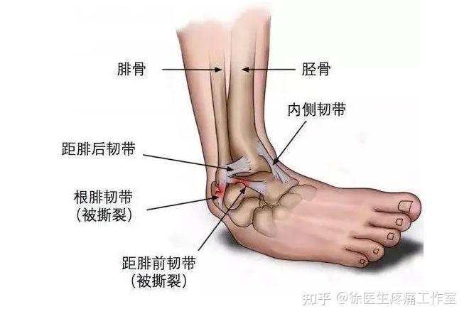 大腿韧带分布图片