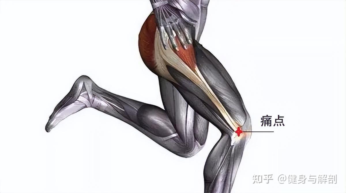 首先,深蹲通常不会引起膝盖疼痛.