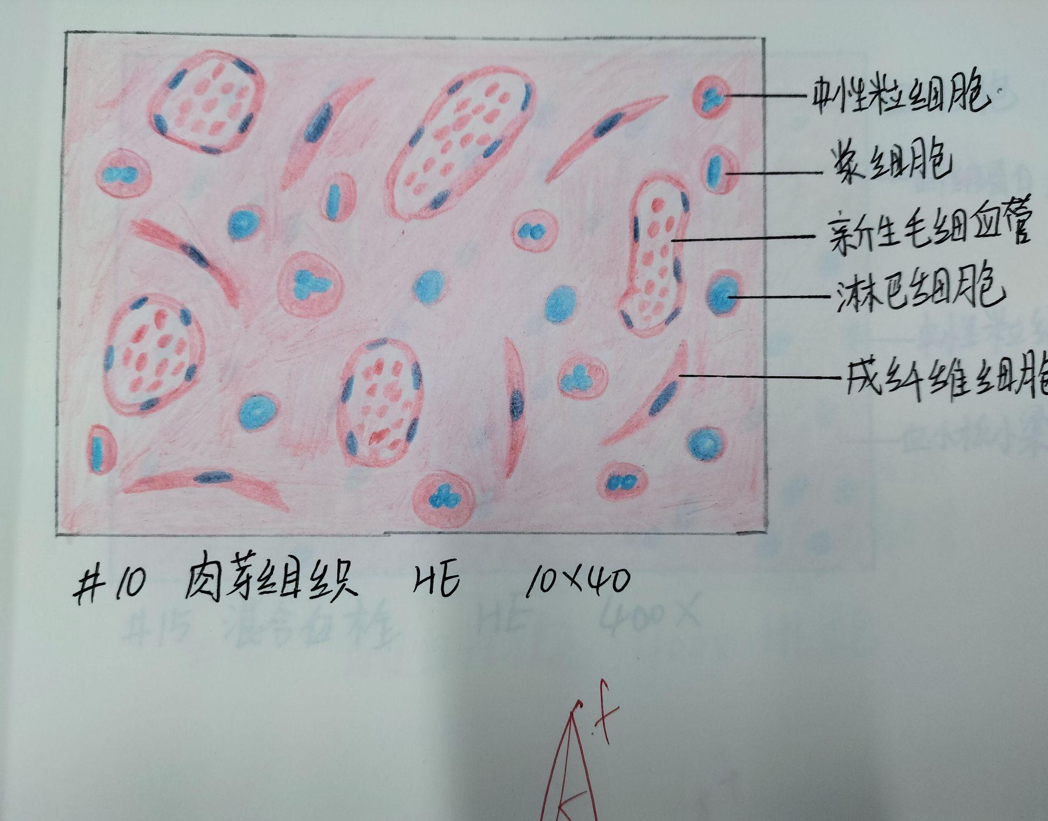 淋球菌的红蓝铅笔图图片