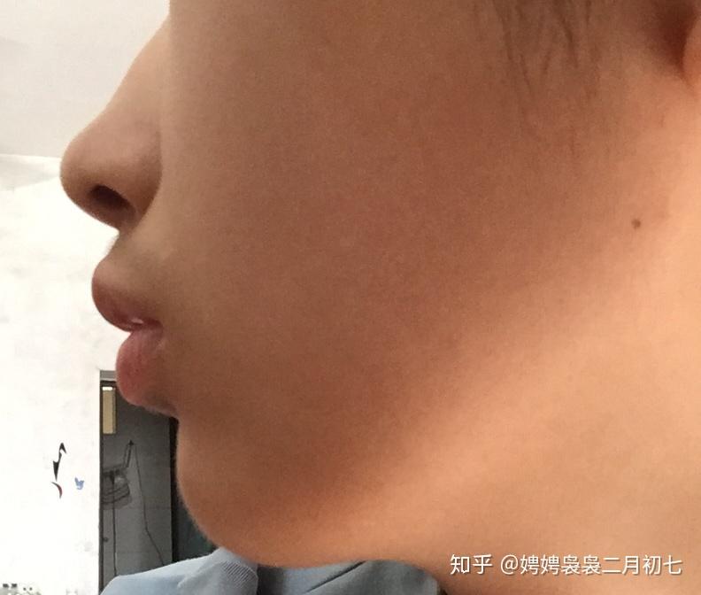 哈哈这玩意要在嘴巴里面呆两年.
