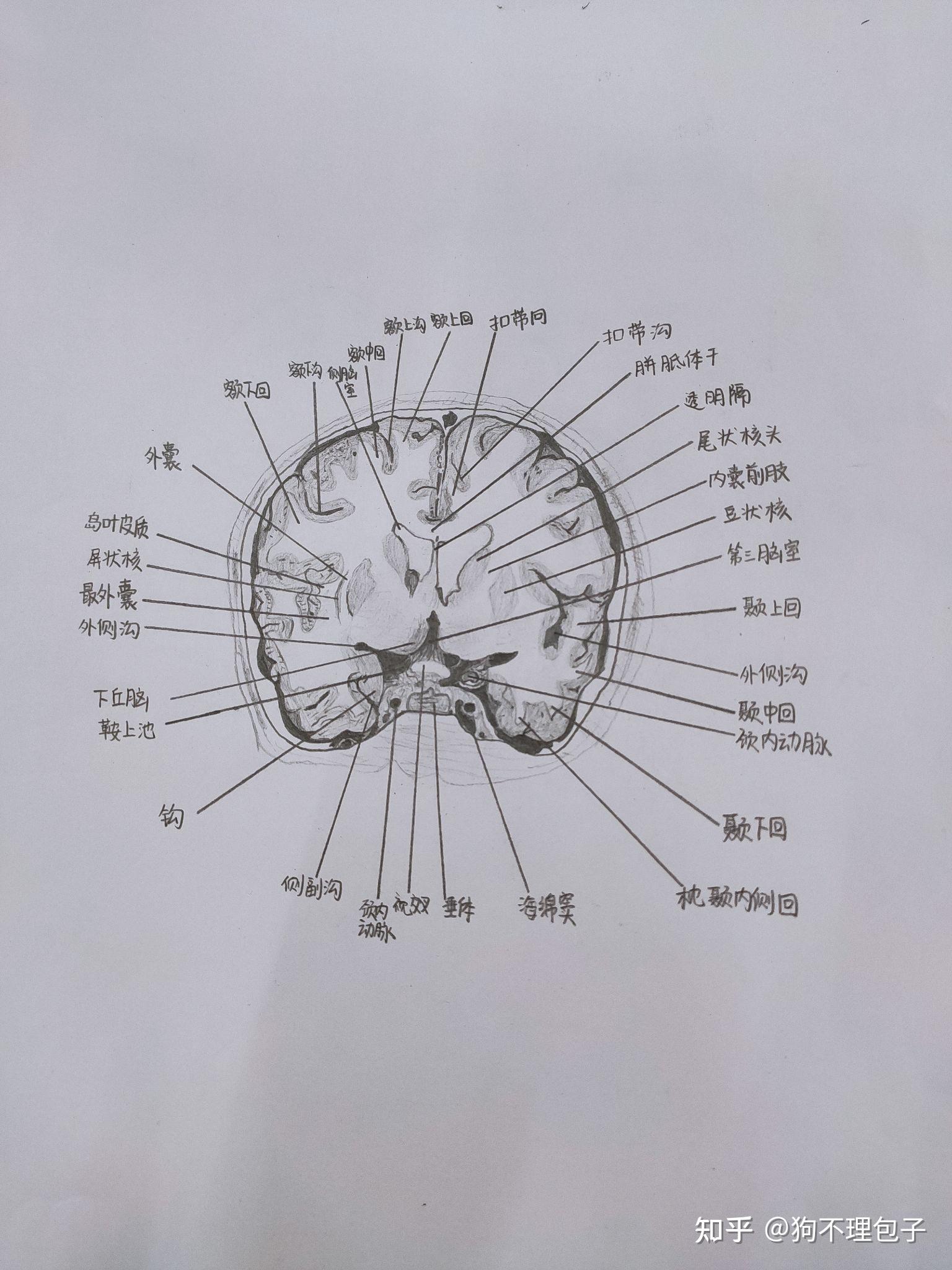 横断面图怎么画手绘图片