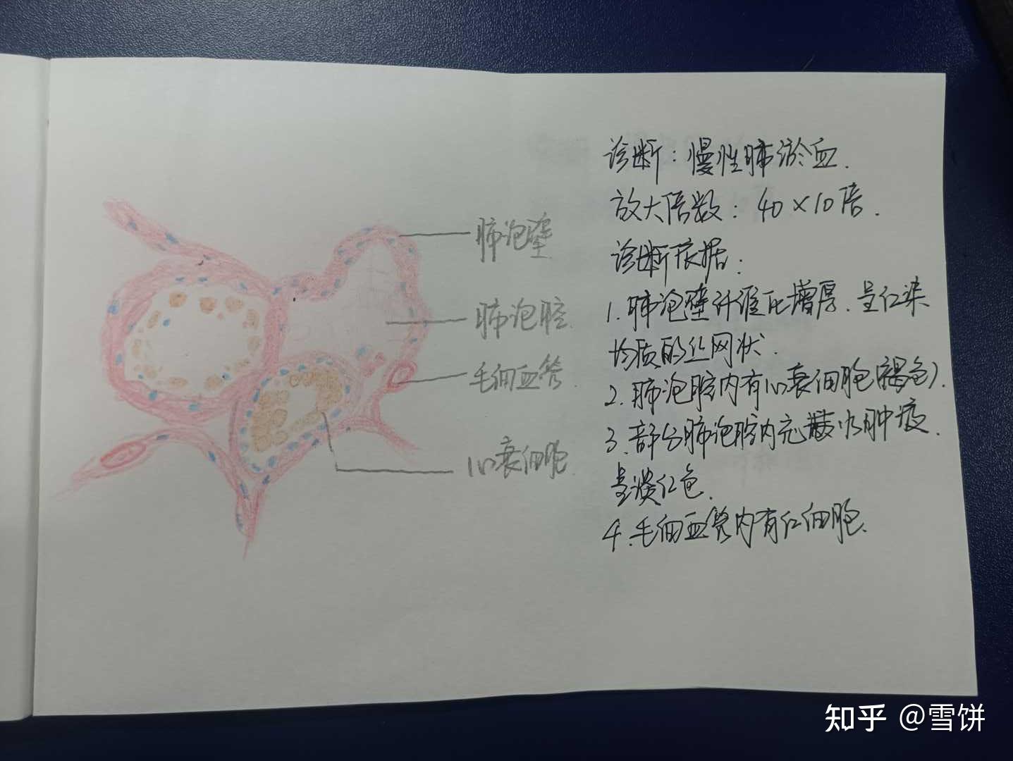 三,慢性肺淤血二,肝脂肪变性一,肉芽组织雪饼