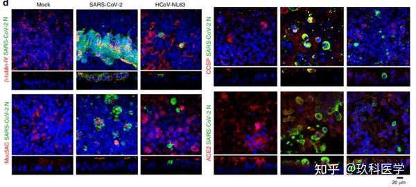 技巧分享 | 免疫荧光实验原来还有那么多细节 - 知乎