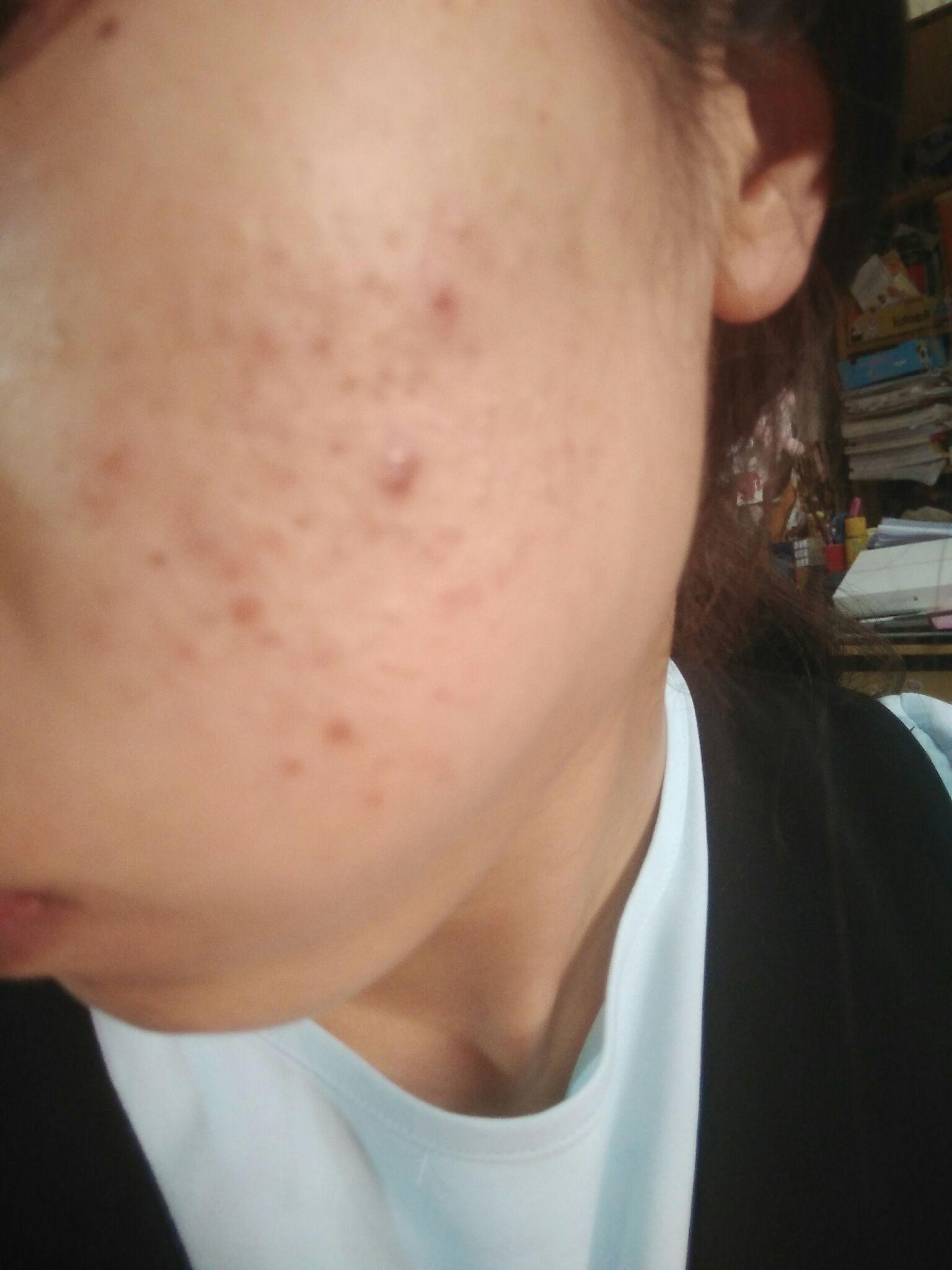 明明脸长的很精致,身材没的说,却总有冒不