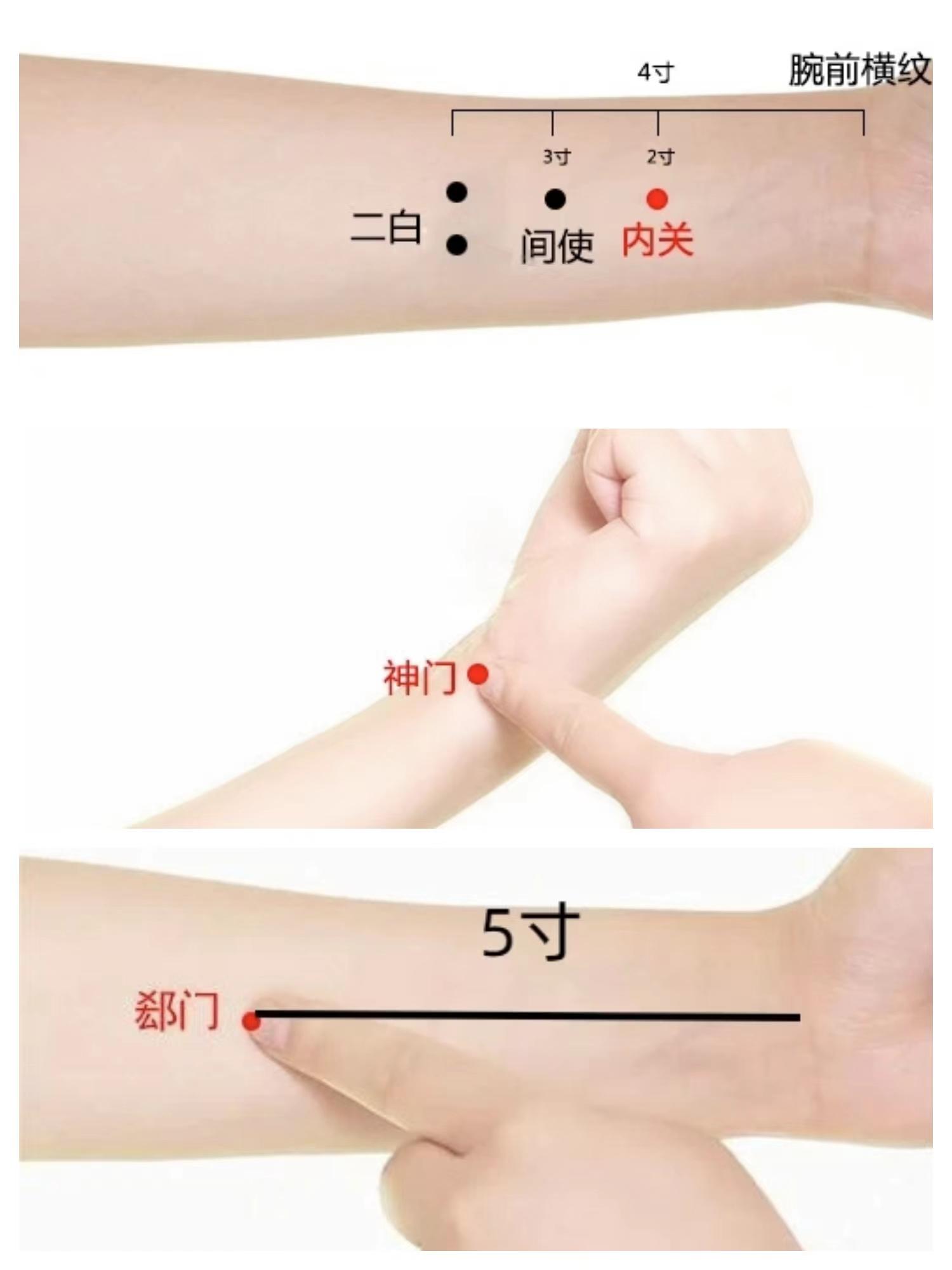 揿针如何治疗慢性心力衰竭？ - 知乎
