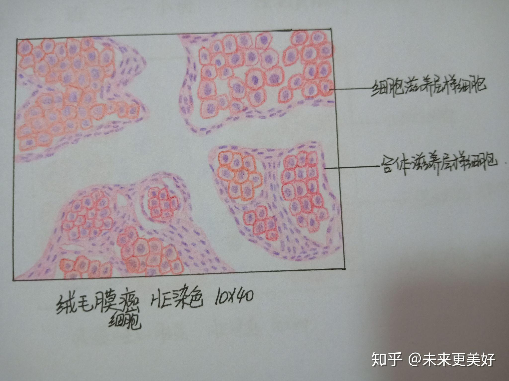 病理學切片紅藍鉛筆手繪圖