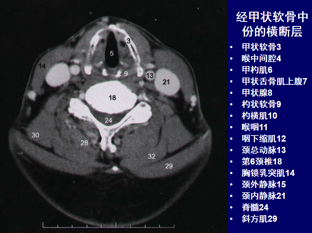 颈部和喉的断层解剖 - 知乎