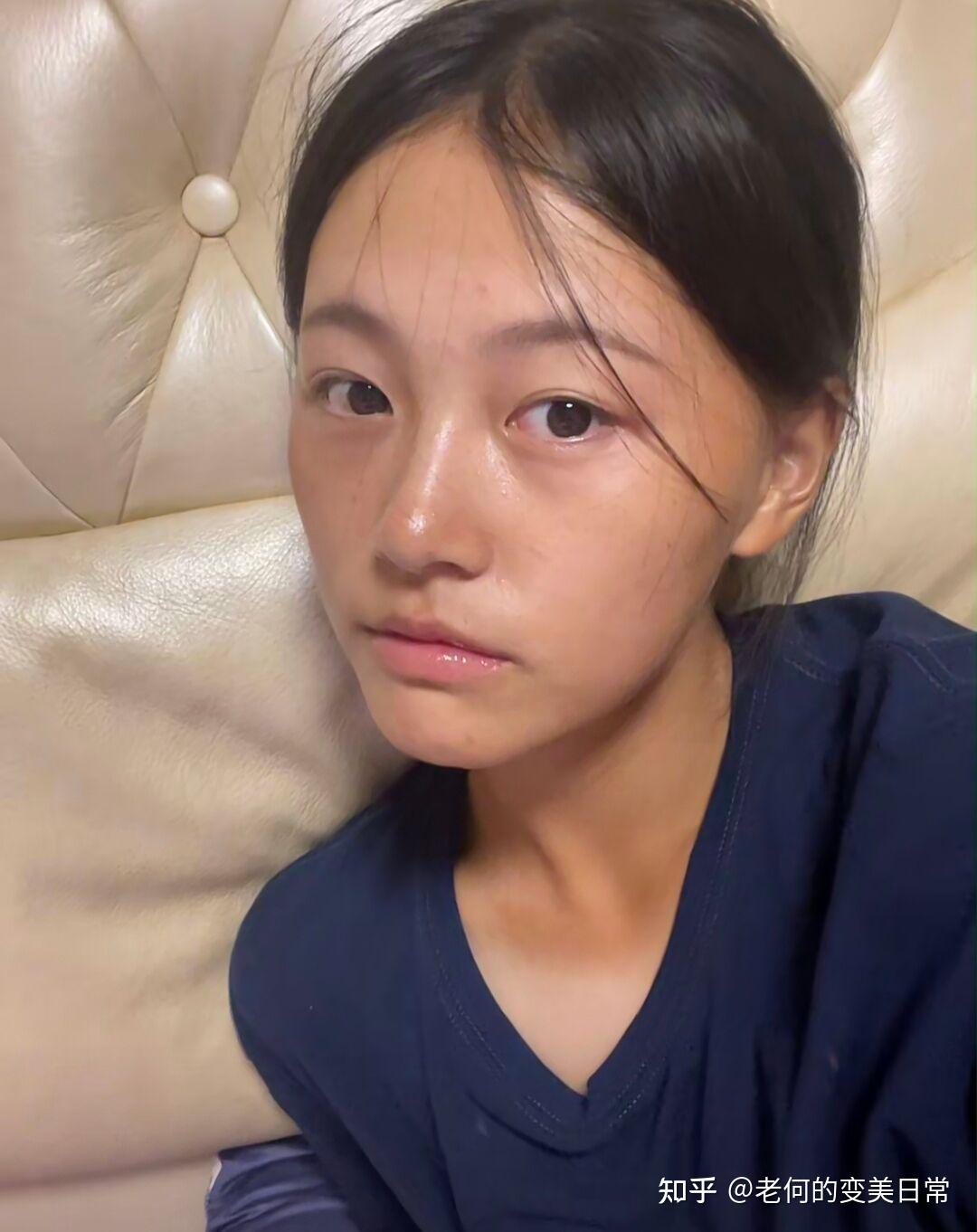 坚持到1个月的时候脸已经明显变白了,早起化妆的时候,室友都建议我