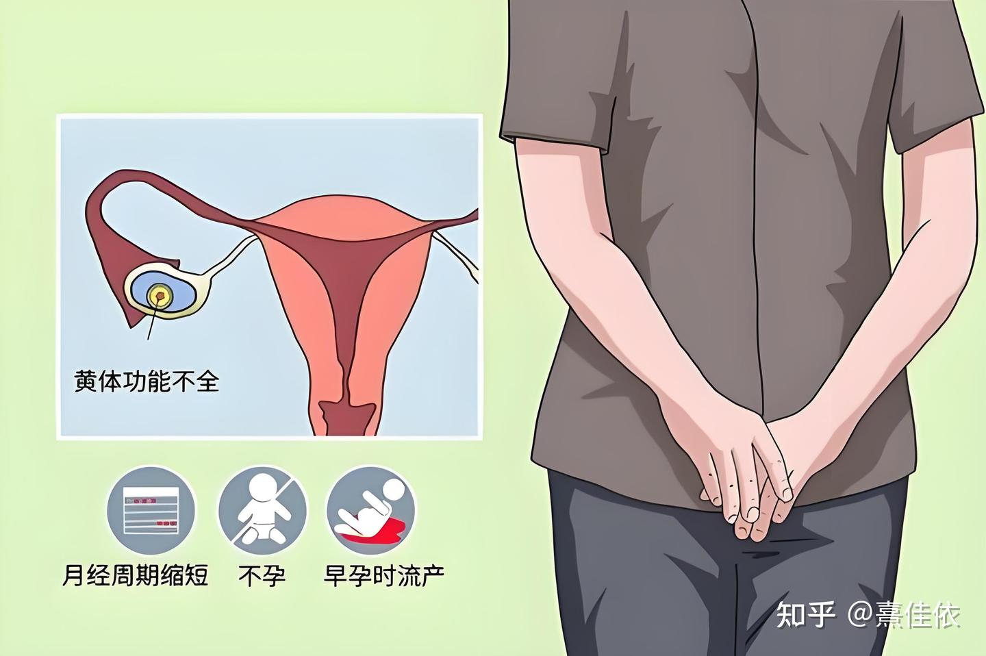 黄体功能不全，竟是难孕和胎停的真凶！ - 知乎