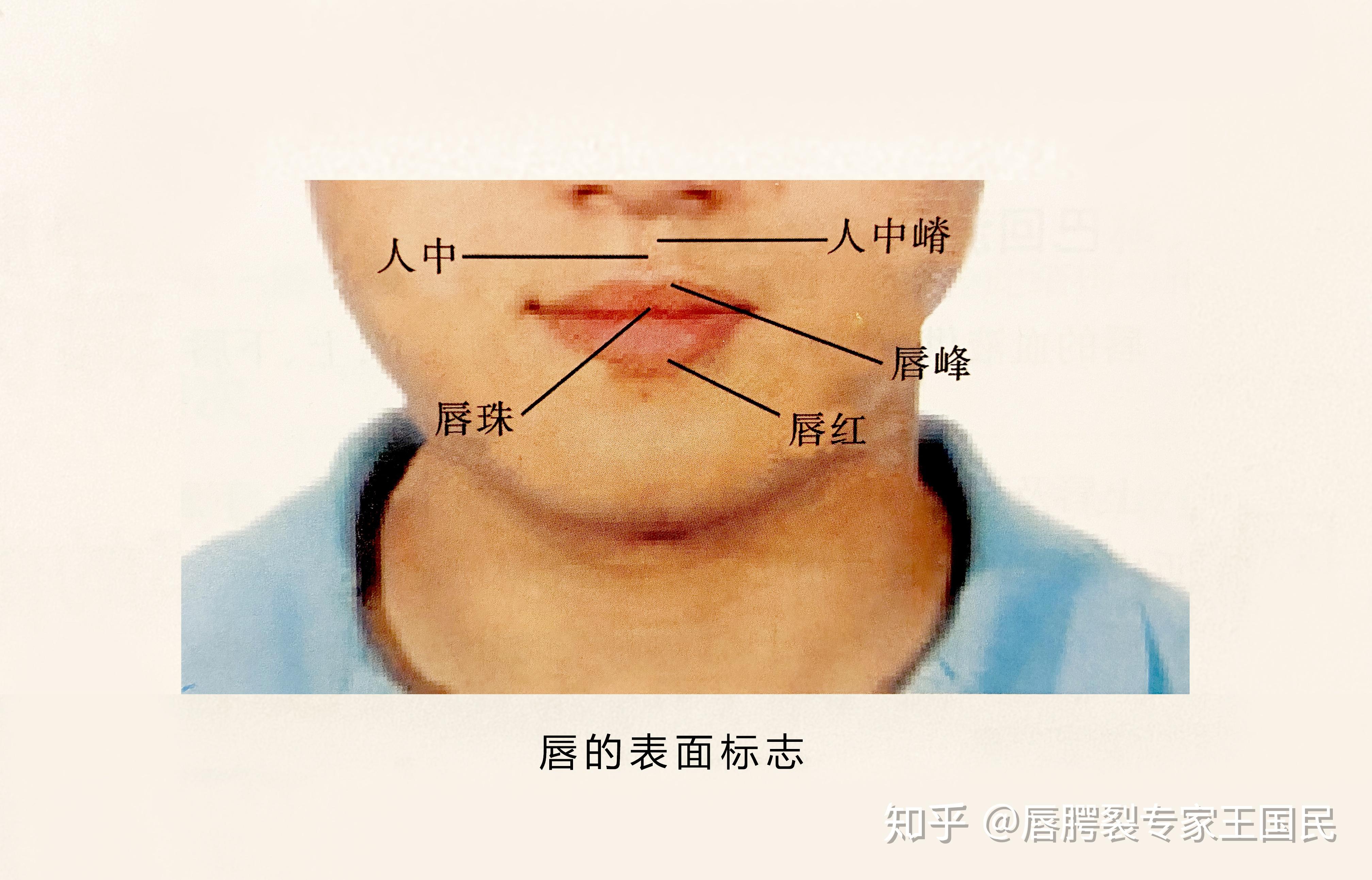 颏唇沟具体位置图片
