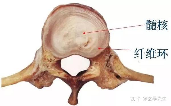腰椎间盘突出症诊断与治疗很详细！ 知乎 