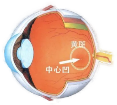 黄斑病变不可逆 三个习惯可预防 - 知乎