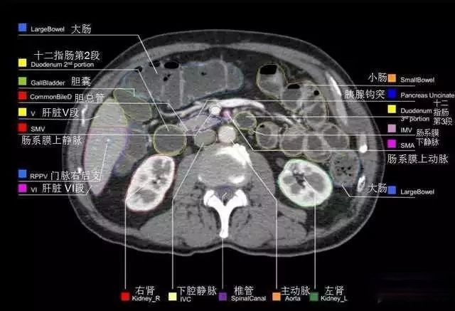 外科医生阅片能力:看完它,再也没有看不懂的腹部CT - 知乎