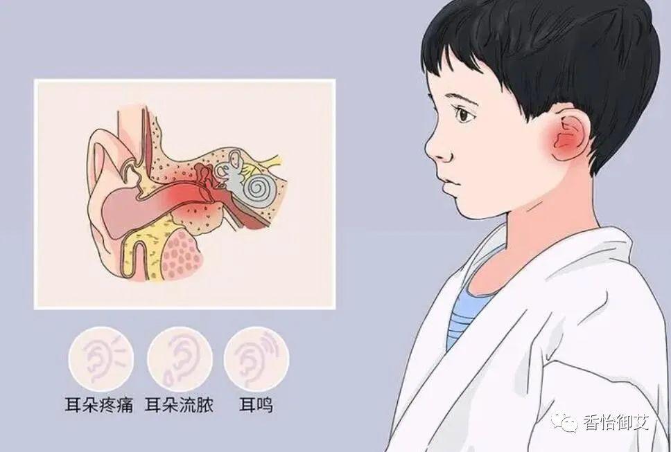 中耳炎是怎么引起的图片