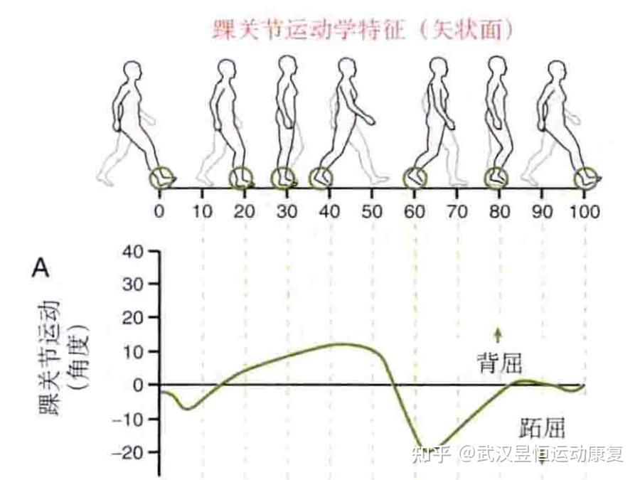 足背屈就是腳背向上勾,一種說法認為和馬桶的出現或下蹲的活動大幅