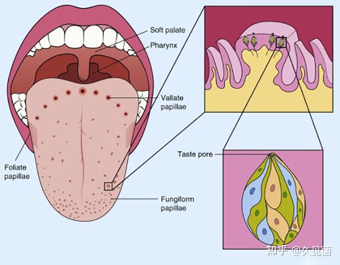 味蕾增生图片图片