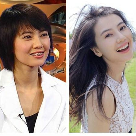 戴过牙套(矫正牙齿)的人脸型变了吗?