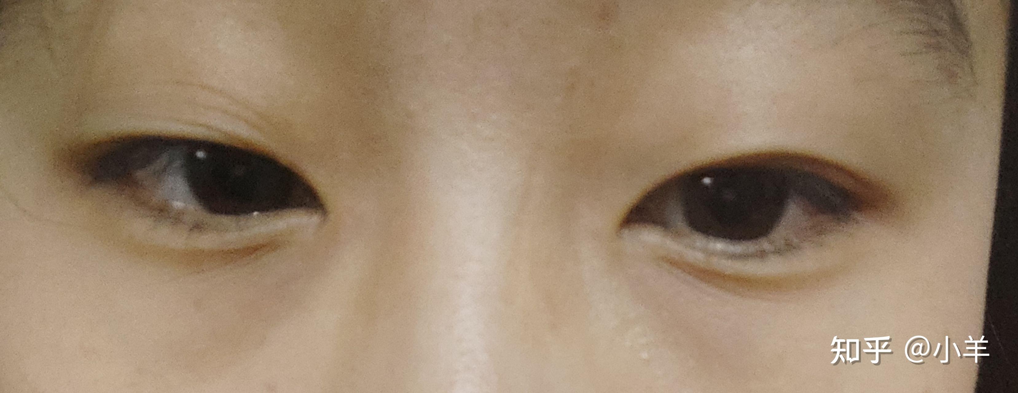 真的很想知道自己的眼形啊 - 知乎