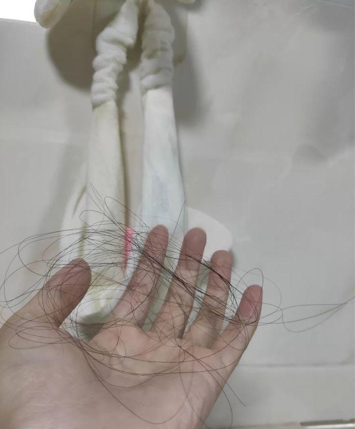 身为一个脱发资深患者两年时间亲测数十款育发液终