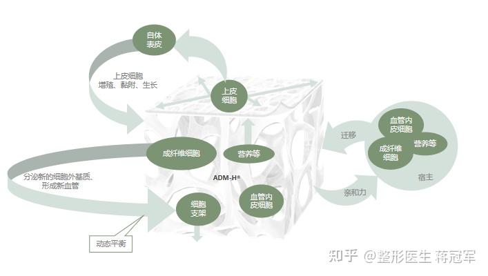 3D生物束带紧缩术能维持几年 - 知乎