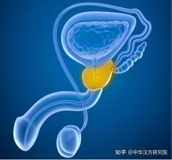中医治疗:前列腺炎的两张处方,三个要点 - 知乎