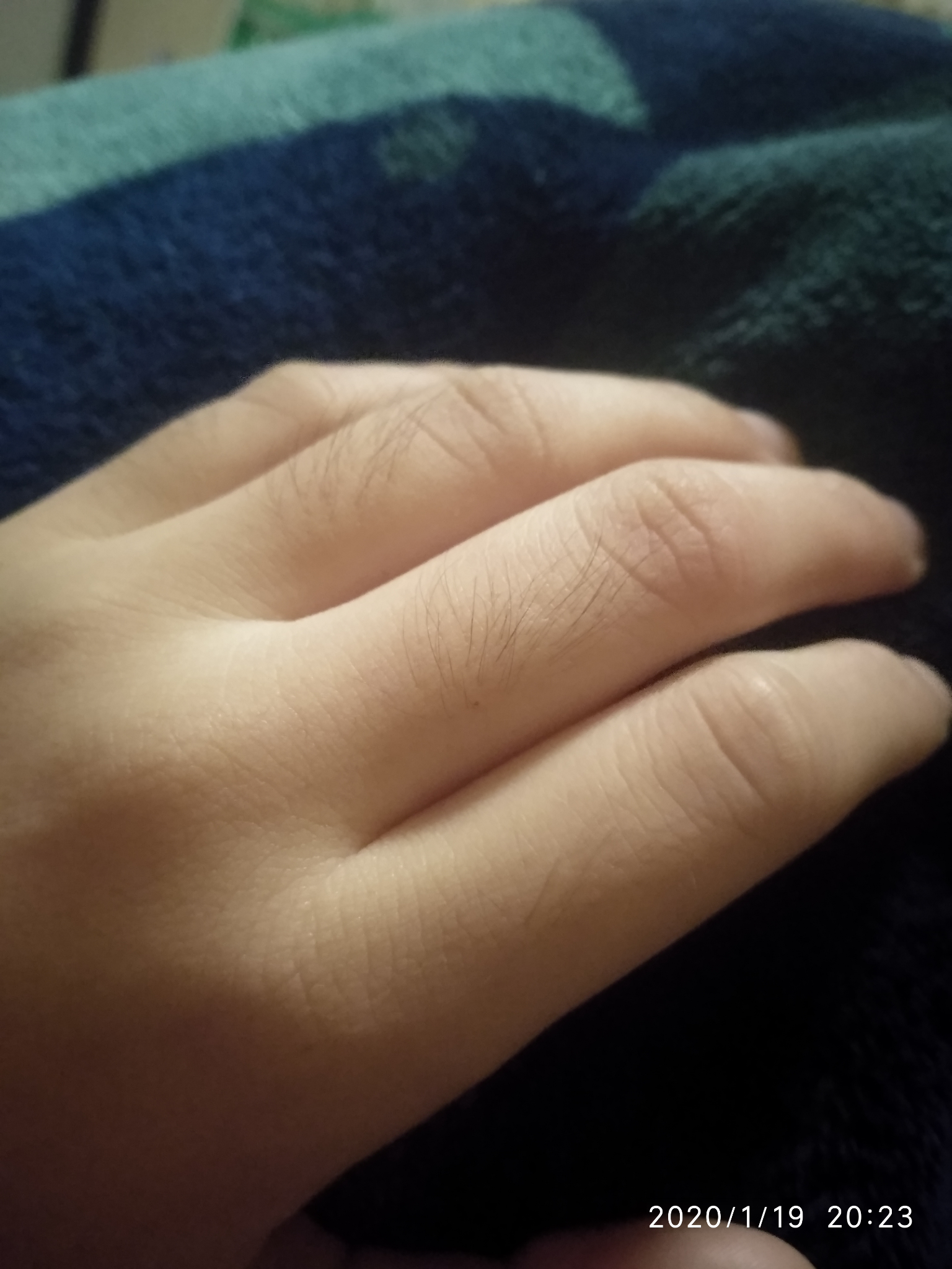 手指上长毛是一种什么样的体验? - 知乎