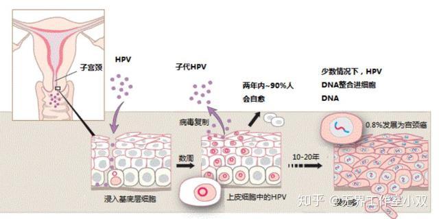 这可能是全网最深度的宫颈癌解读了,强烈建议收藏!!! - 知乎