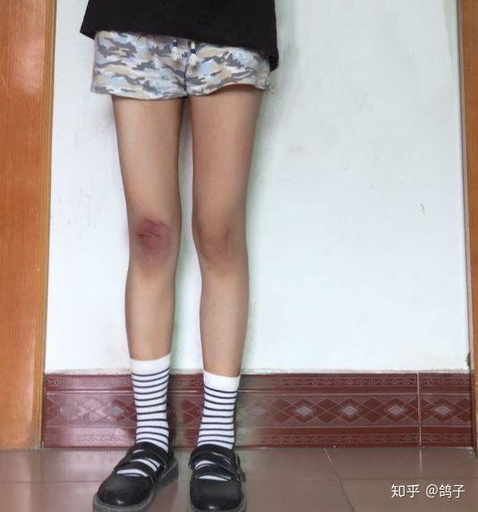 小腿围32真的不胖吗.