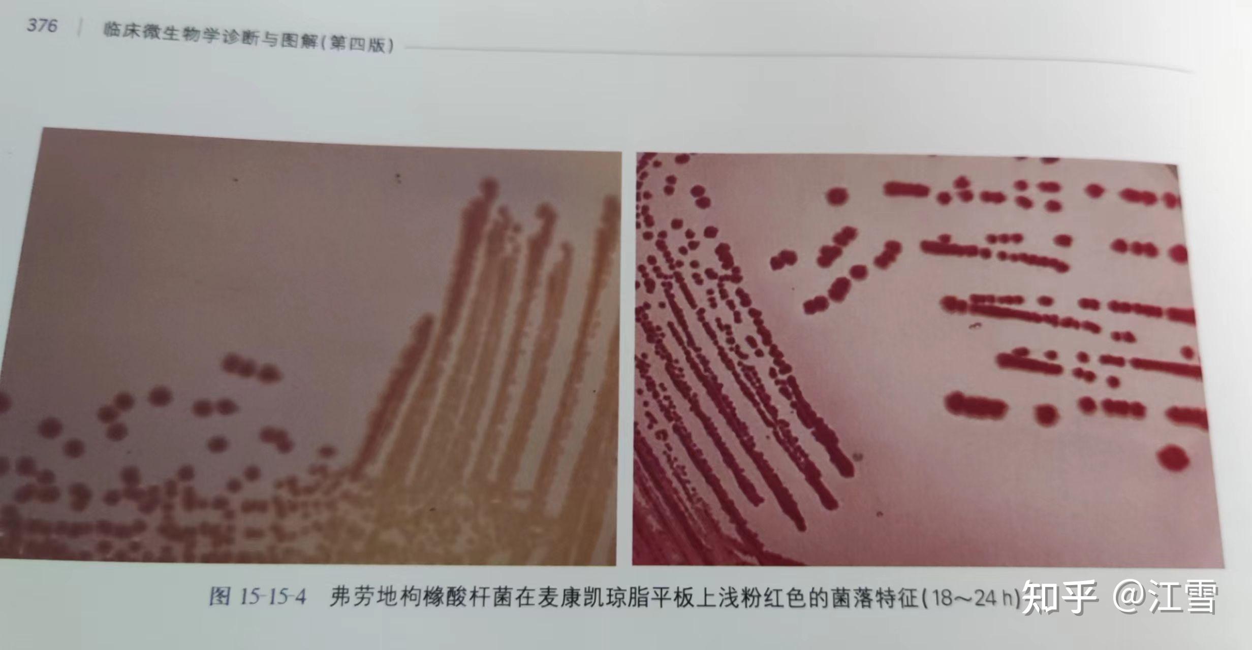 临床微生物学诊断与图解(第四版)上册 375页 枸橼酸杆菌属#弗劳地枸橼酸杆菌 - 知乎