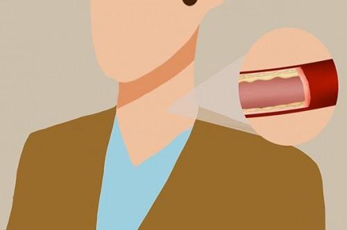 什么颈椎贴好用 v2-bd2a004ea6ae5516d3b6c8ea52ddc9e7_r.jpg