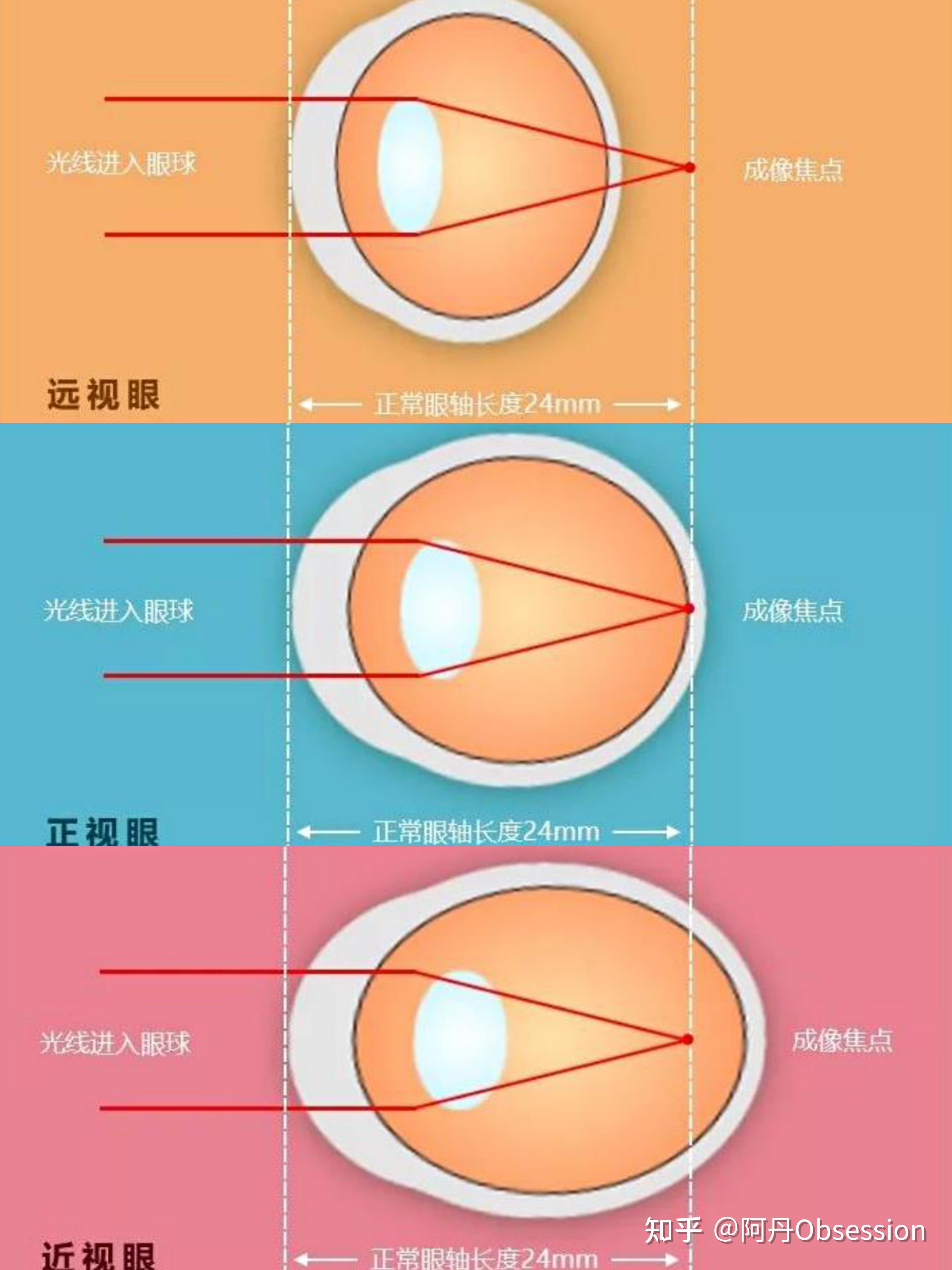 成长乐镜片原理图片