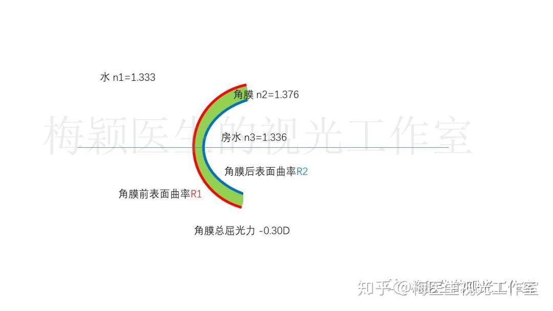 图3  当角膜前表面是水时,角膜的屈光力大幅度减少n1 水的折射率 1