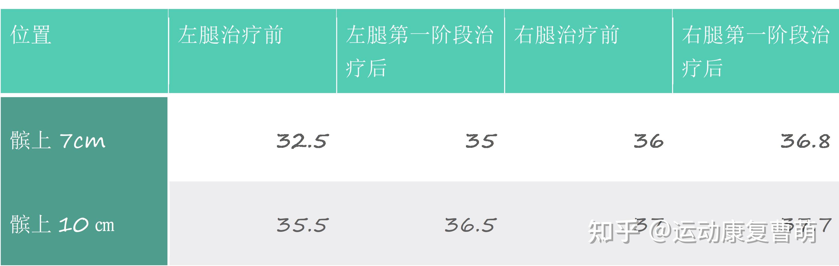 精選案例半月板損傷後切忌靜養找對方法幫你少走彎路