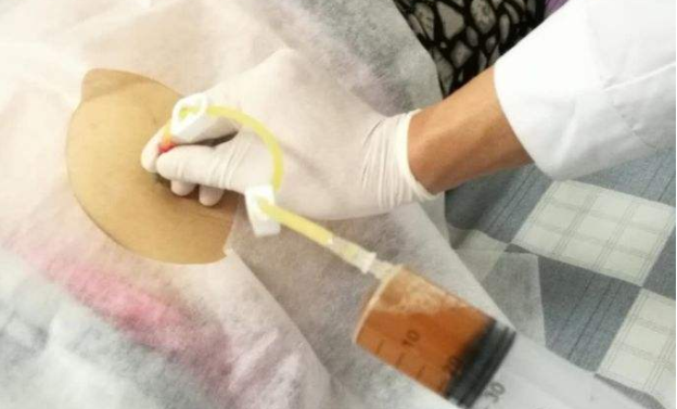 首发于胸腹水 写文章