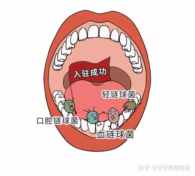 前不刷牙的人,到后来,口腔中会滋生很多的细菌,从而会患上口腔疾病