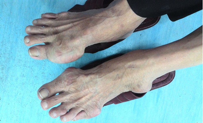 先天之本—肾脏疾病的危害 - 知乎