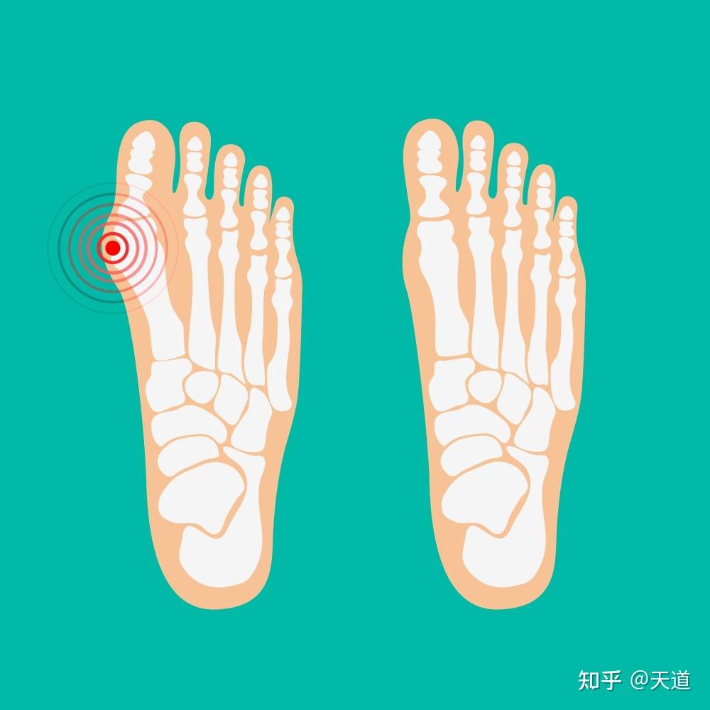 脚拇指的叫法图解图片