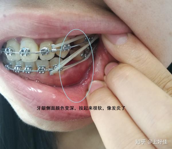 全同步带状弓整牙日记每周一更