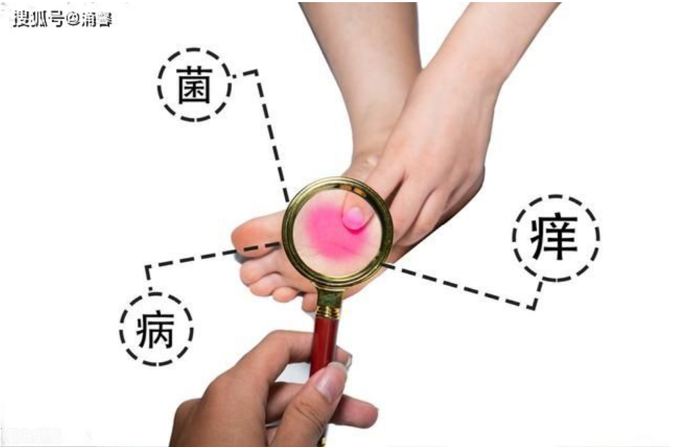 长脚气是什么原因 知乎 长脚气是什么原因 知乎