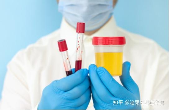 尿液浑浊是什么原因造成的?出现尿液浑浊该怎么办? - 知乎