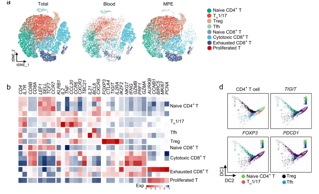 项目文章单细胞转录组测序揭示恶性胸腔积液中的免疫细胞特征