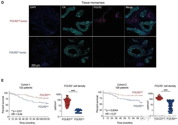 Cell热点 I 乳腺癌良好预后的新型生物标志物— FOLR2+巨噬细胞 - 知乎