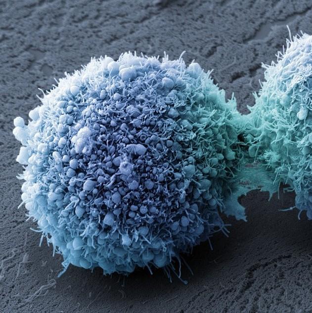 nature子刊:缺氧是导致癌细胞不断肆虐的元凶