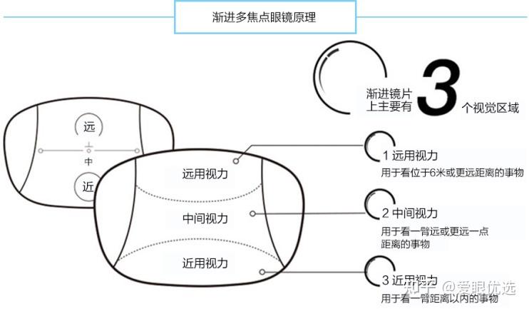 眼镜中的“渐进镜”是什么? - 知乎