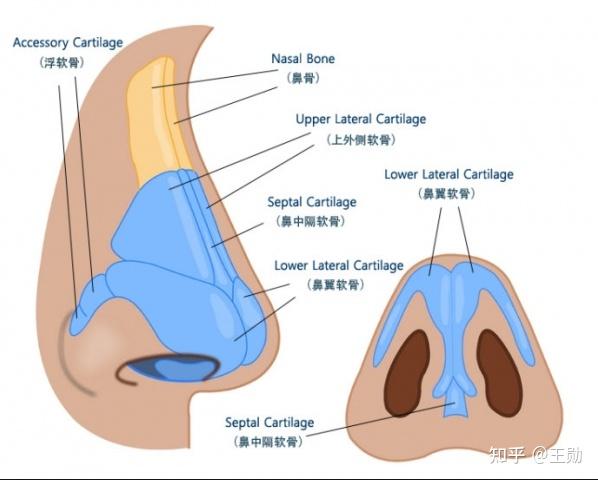 鼻软骨发育不良图片